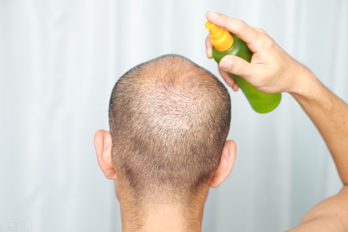 ͷƤġСʲôӰ콡𣿱ĸ